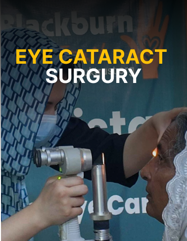 eye cataract Surgury